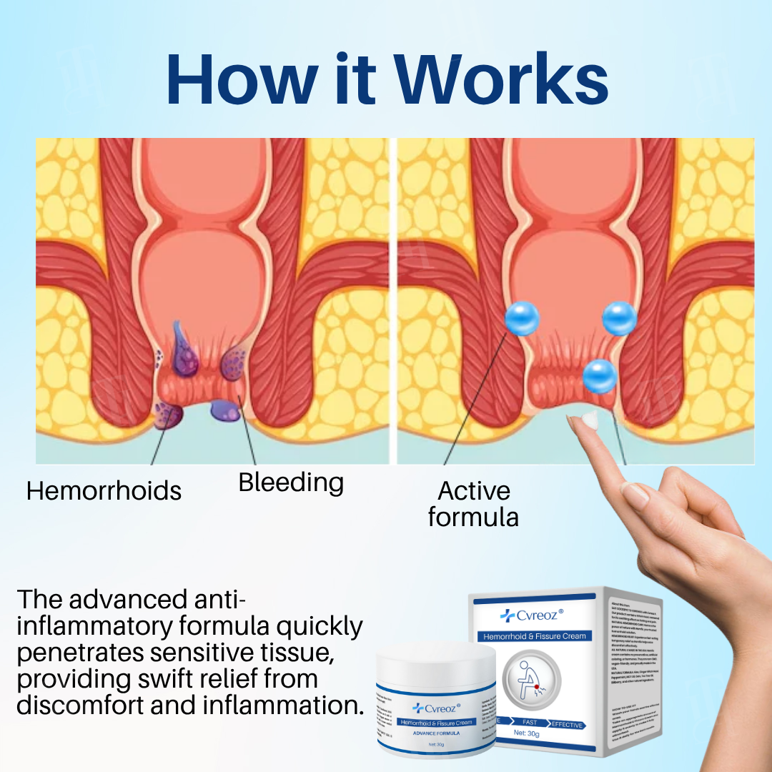 Official Store: Cvreoz® Hemorrhoid & Fissure Cream-7 Days to a Happy, Pain-Free —Guaranteed!